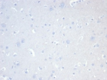 Recombinant CD20 Antibody