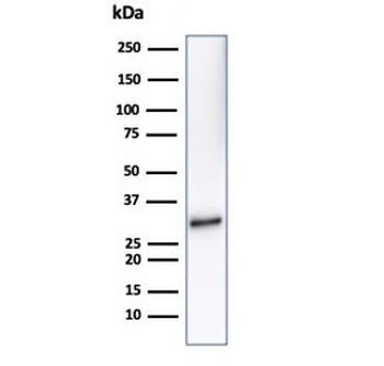 Recombinant CD20 Antibody