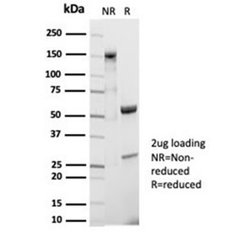 Recombinant CD20 Antibody