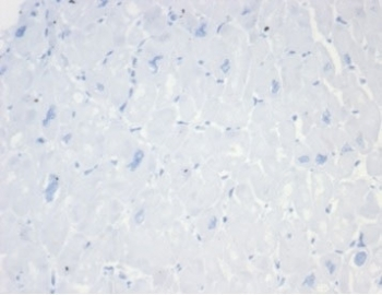 Recombinant CD20 Antibody