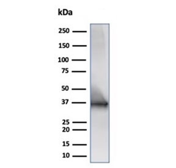 Recombinant CD20 Antibody