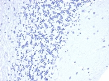 Recombinant CD5 Antibody