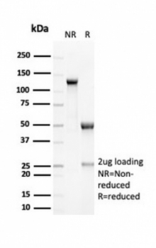 Recombinant EBAG9 Antibody / RCAS1