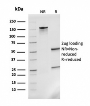 MCP2 Antibody / CCL8