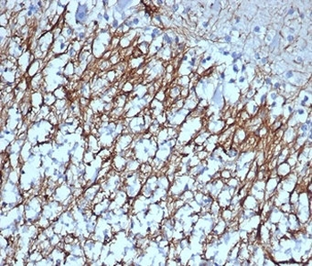 GFAP Antibody / Glial Fibrillary Acidic Protein