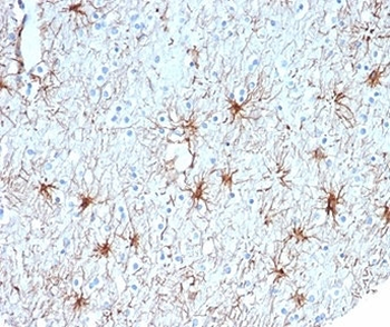GFAP Antibody / Glial Fibrillary Acidic Protein