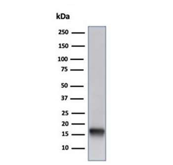 Recombinant Fatty Acid Binding Protein 5 Antibody / FABP5