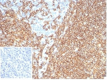 Recombinant CD20 Antibody