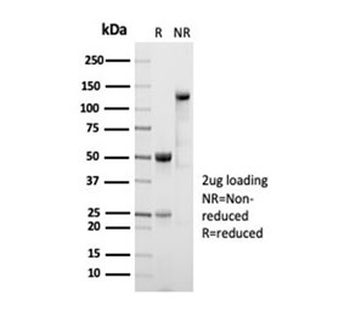 Recombinant Aldehyde Dehydrogenase 1A1 Antibody / ALDH1A1