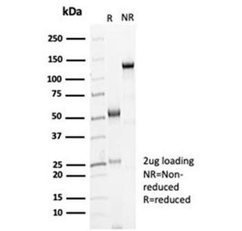 Recombinant CDH16 Antibody / Cadherin 16
