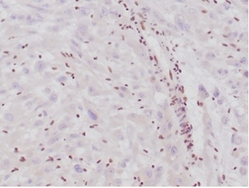 Integrase interactor 1 Antibody / INI1 / SMARCB1 / BAF47