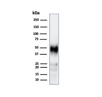 Recombinant CD2 Antibody