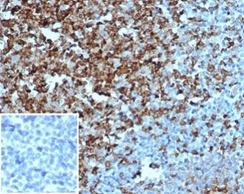Recombinant CD2 Antibody