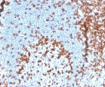 Recombinant CD2 Antibody