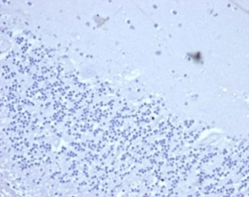 Recombinant CD2 Antibody