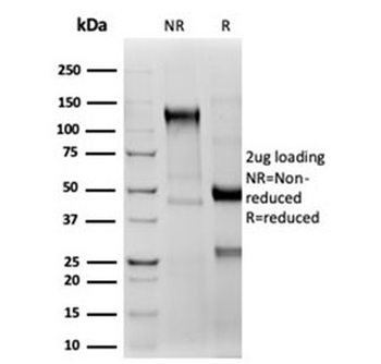 Recombinant CD2 Antibody