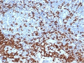 Recombinant CD3e Antibody / CD3 epsilon
