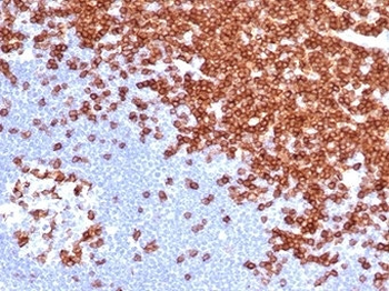 Recombinant CD3e Antibody / CD3 epsilon