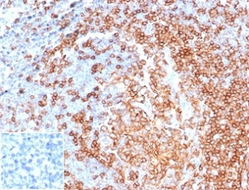 Recombinant CD22 Antibody