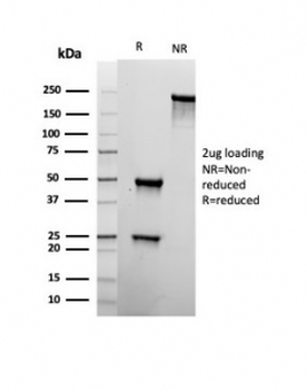 Recombinant CD22 Antibody
