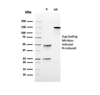 Recombinant DNA topoisomerase I Antibody / TOP1MT