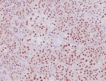 Recombinant SF-1 Antibody / Steroidogenic Factor 1 / NR5A1