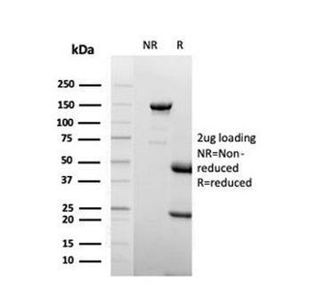 Lactoferrin Antibody / LTF / Lactotransferrin