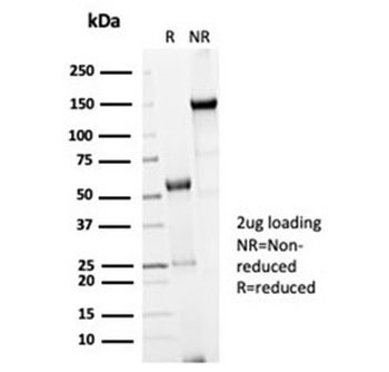 Recombinant Cdc20 Antibody