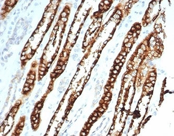Recombinant Cadherin 16 Antibody / CDH16