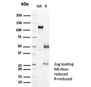 Recombinant Cadherin 16 Antibody / CDH16