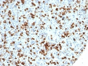 Recombinant CD59 Antibody