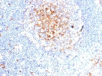 Recombinant CD59 Antibody