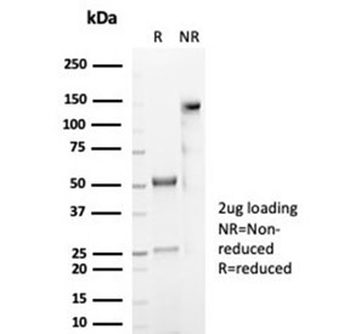 Recombinant CD59 Antibody