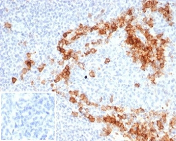 Recombinant CD38 Antibody