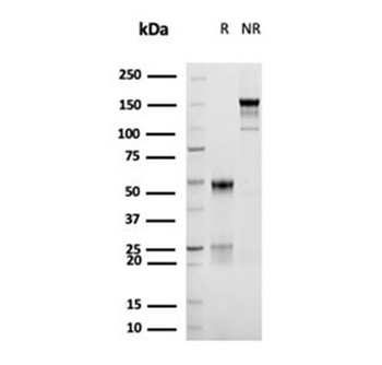 Recombinant CD30 Antibody