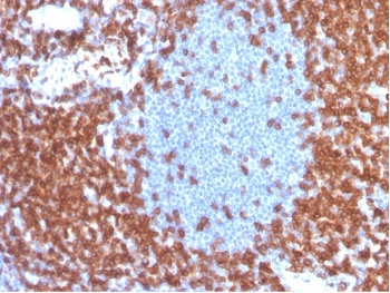 Recombinant CD3 epsilon Antibody