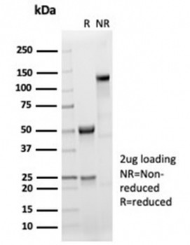 Recombinant Sarcomeric Alpha Actinin Antibody / Alpha Actinin 2 / ACTN2