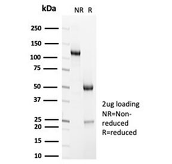 Recombinant Alpha Actinin 2 Antibody / ACTN2 / Sarcomeric Alpha Actinin