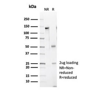 Recombinant CAD Antibody / CALD1 / Caldesmon