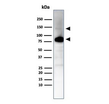Recombinant CAD Antibody / CALD1 / Caldesmon