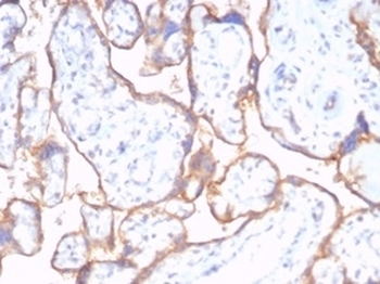Recombinant CD59 Antibody