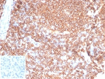 Recombinant CD45RA Antibody (Leukocyte marker)