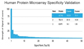 Recombinant ACTN2 Antibody / Alpha Actinin 2 / Sarcomeric Alpha Actinin