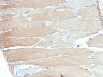 Recombinant ACTN2 Antibody / Alpha Actinin 2 / Sarcomeric Alpha Actinin