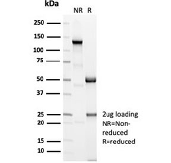 Recombinant ACTN2 Antibody / Alpha Actinin 2 / Sarcomeric Alpha Actinin