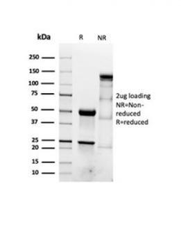 Recombinant Actin Antibody / ACTA2 / Smooth Muscle