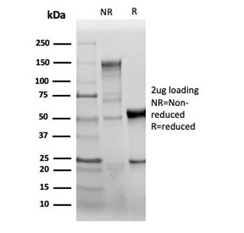Recombinant PECAM-1 Antibody / CD31