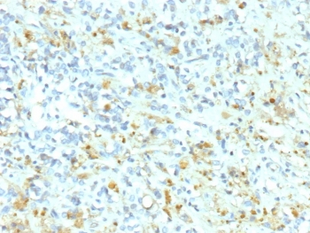 ALK Antibody / Anaplastic Lymphoma Kinase