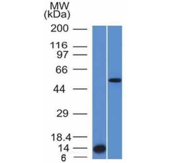 Anaplastic Lymphoma Kinase Antibody / ALK