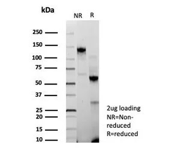 Recombinant BRCA1-Associated Protein 1 Antibody / BAP1